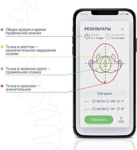 Интеллектуальный корректор осанки iBACK (White) купить в интернет-магазине icover