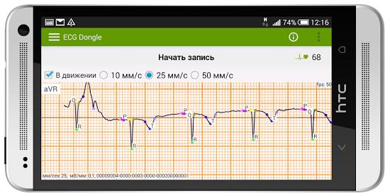 ECG Dongle + Lightning to USB - кардиофлешка с адаптером (Turquoise) купить в интернет-магазине icover