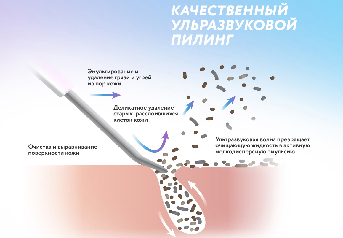 Аппарат для ультразвуковой чистки лица Yamaguchi Brilliant (White) купить в интернет-магазине icover