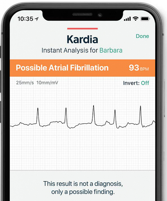 Портативный электрокардиограф AliveCor KardiaMobile EKG для iOS/Android (Black) купить в интернет-магазине icover