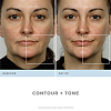 Аппарат для повышения тонуса лица NuFace Trinity (White) купить в интернет-магазине icover