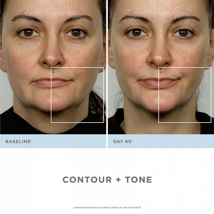 Аппарат для повышения тонуса лица NuFace Trinity (White) купить в интернет-магазине icover