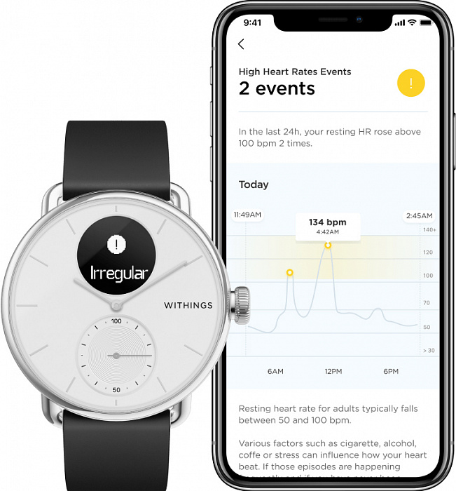 Умные часы Withings ScanWatch 38mm (Black) купить в интернет-магазине icover