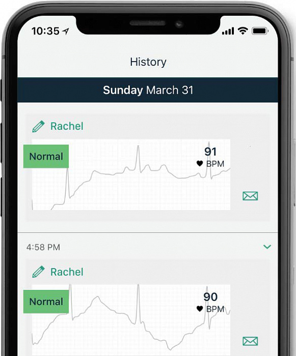 Портативный электрокардиограф AliveCor KardiaMobile EKG для iOS/Android (Black) купить в интернет-магазине icover