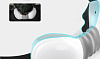 Массажер для шеи и плеч Jeeback Neck Massager MG2 JA301 (White) купить в интернет-магазине icover