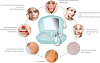 Аппарат для аквапилинга и вакуумной чистки лица Gezatone Aqua Peeling MD-3a 400 (Blue) купить в интернет-магазине icover