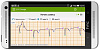 Кардиофлешка ECG Dongle пульсометр купить в интернет-магазине icover