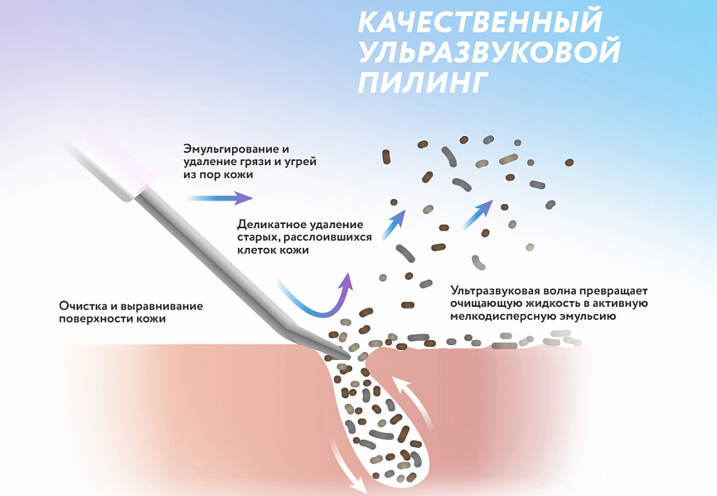 Аппарат для ультразвуковой чистки лица Yamaguchi Brilliant (White) купить в интернет-магазине icover